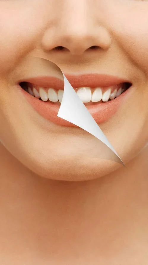 Teeth whitening